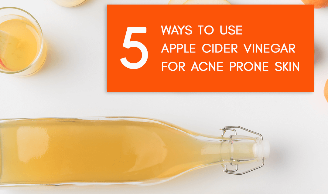 5 recipes to use Apple Cider Vinegar for Acne Urban Gyal