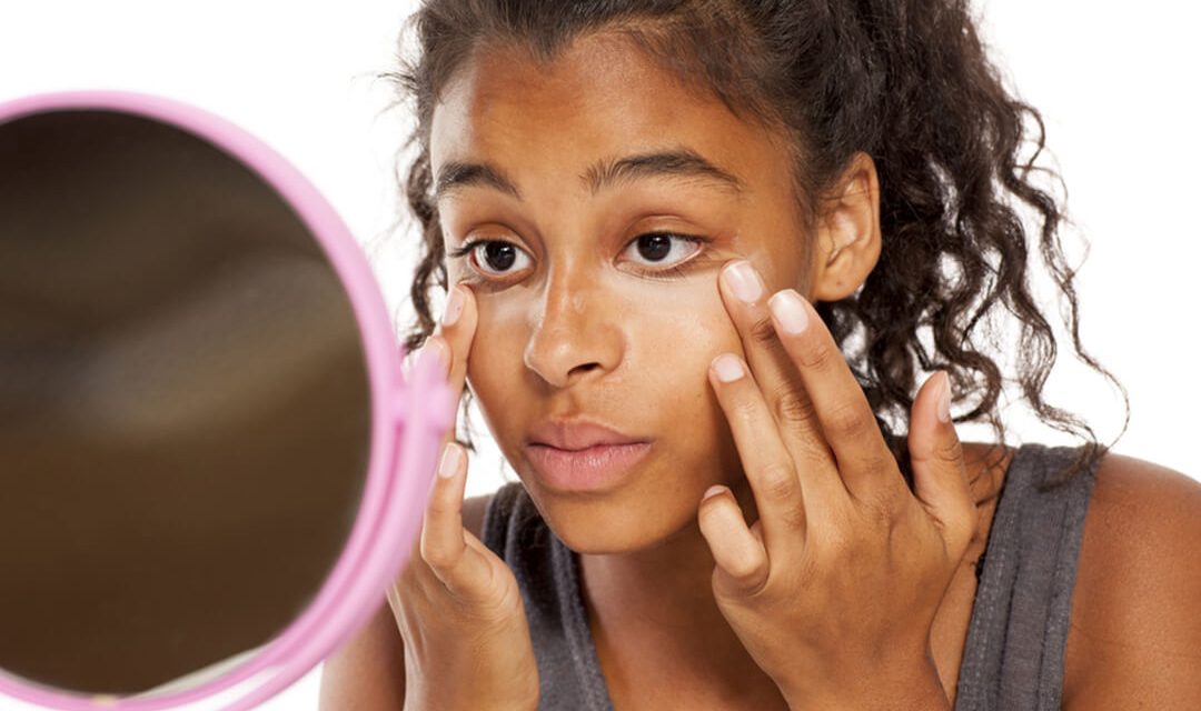Get Rid Of Dark Eye Circles For Good With These 5 Eye Masks